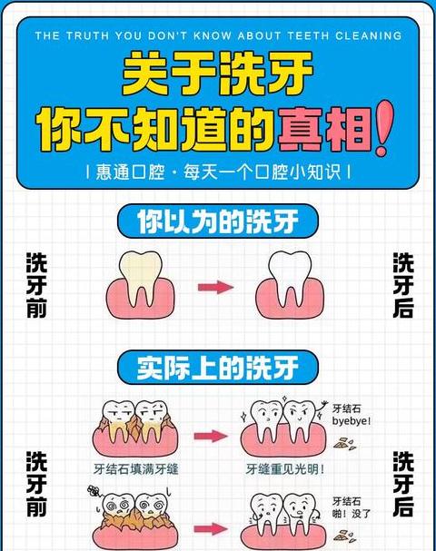 牙签遇到洗洁精的原理20字