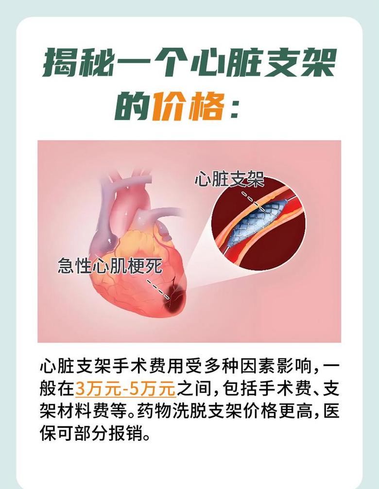 心脏放支架后一般寿命多久