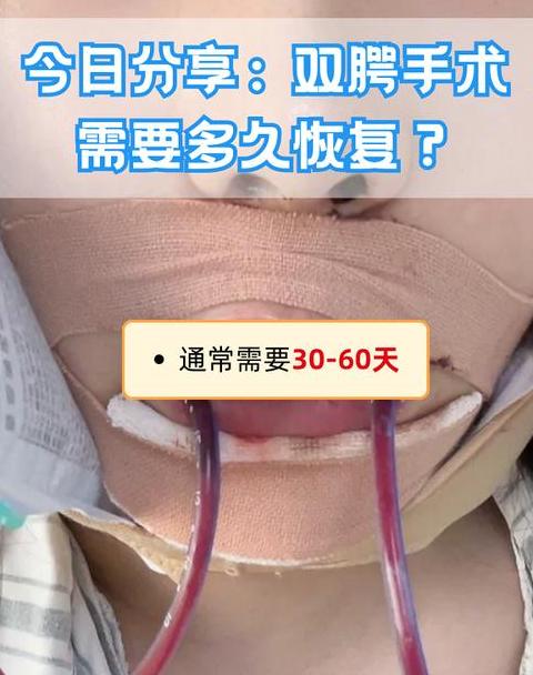 口腔手术线多久会吸收干净